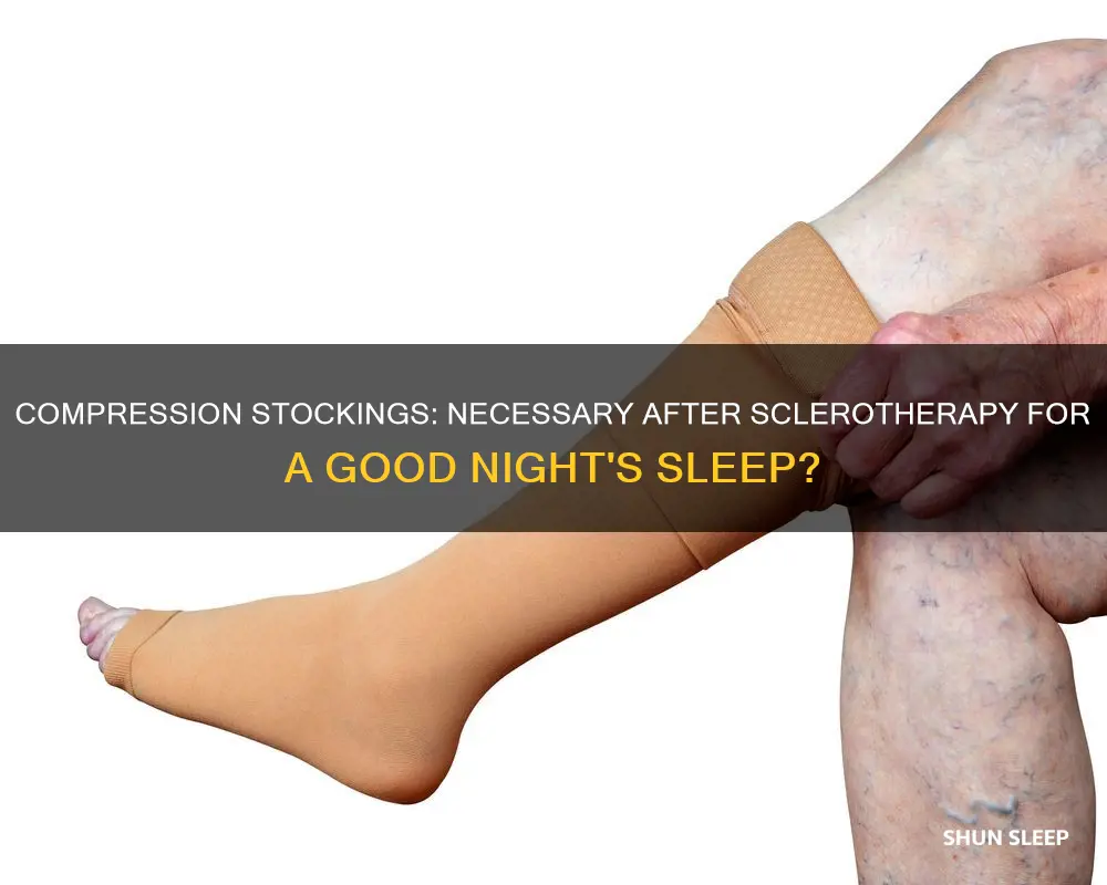 do i need to sleep in compression stockings after sclerotherapy