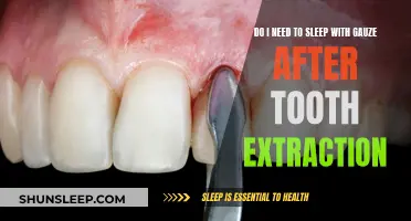 Gauze and Tooth Extraction: When to Use It