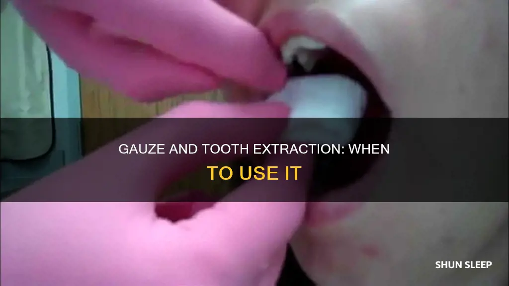 do i need to sleep with gauze after tooth extraction
