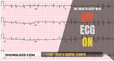 Should You Sleep with Your ECG On?