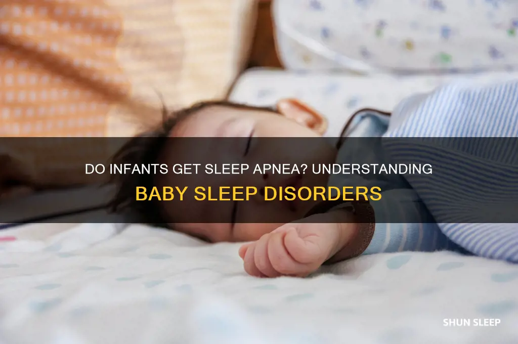 do infants get sleep apnea