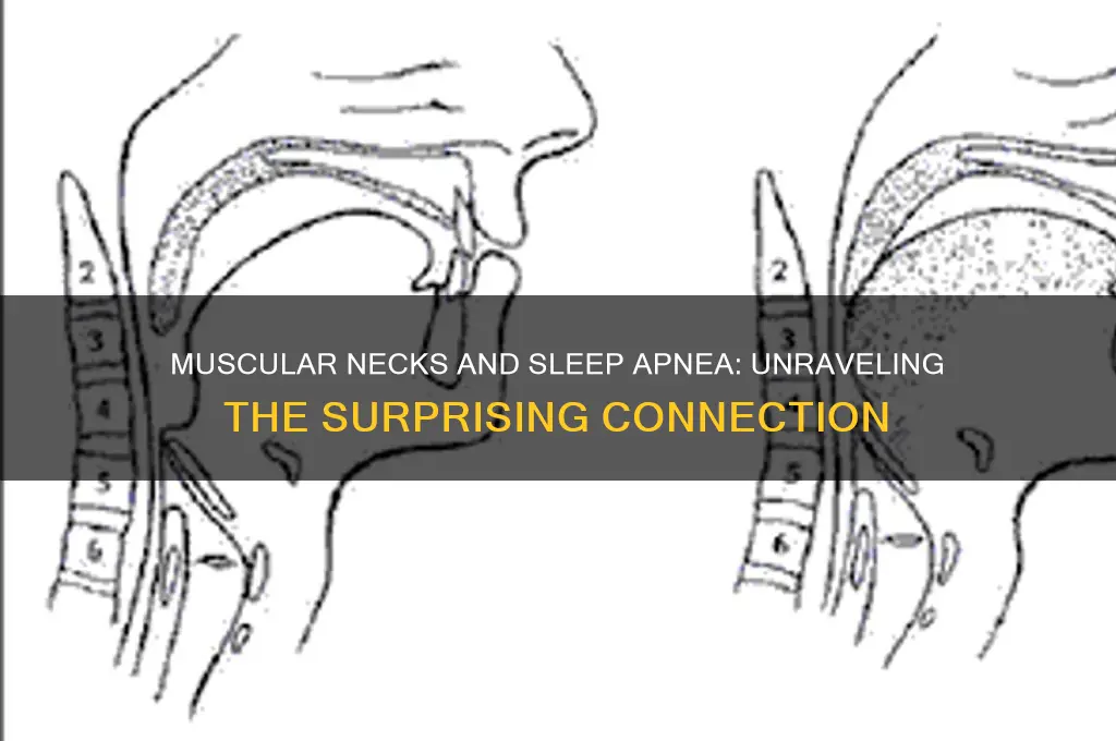 do men with muscular necks get sleep apnea
