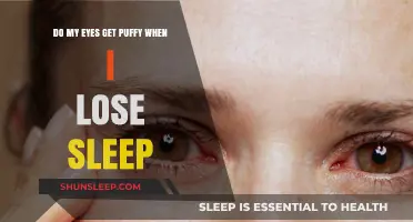 Sleep Deprivation and Puffy Eyes: Understanding the Connection and Remedies