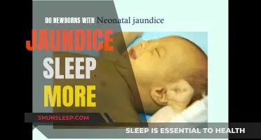 Jaundice in Newborns: Excessive Sleep and Treatment Options