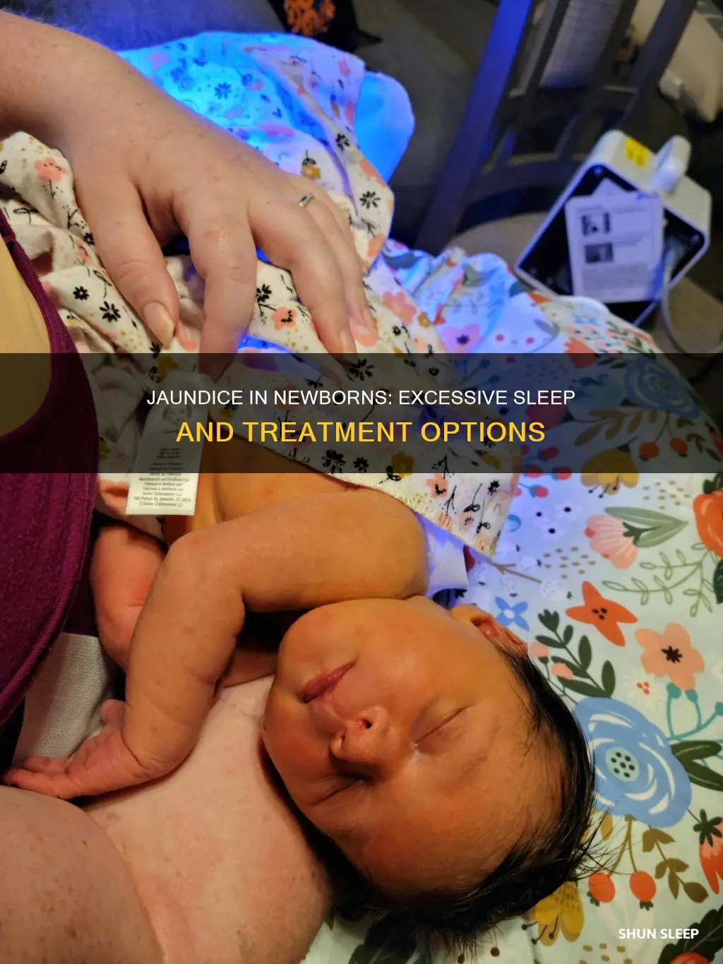 do newborns with jaundice sleep more