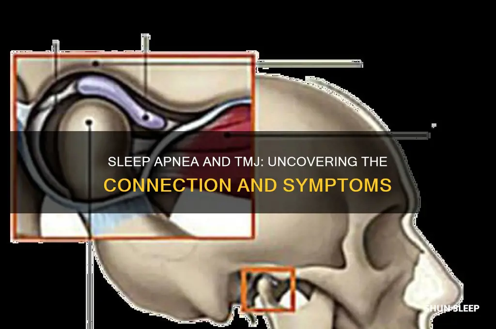 do people with obstructive sleep apnea get tmj symptoms