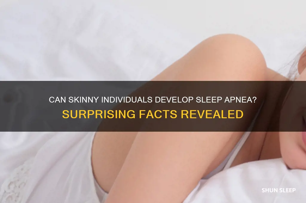 do skinny people get sleep apnea