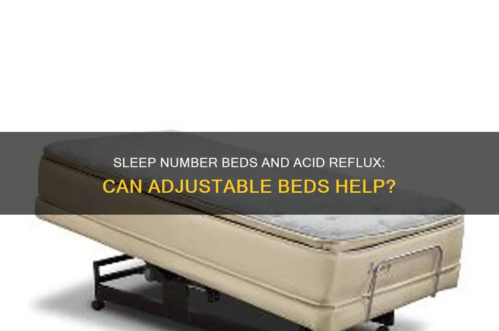 do sleep number beds help with acid reflux