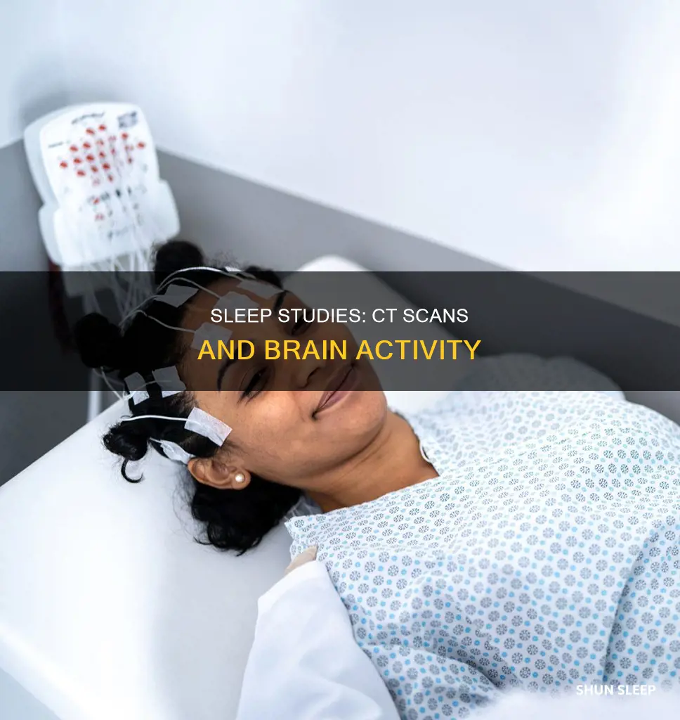 do sleep studies use ct scans