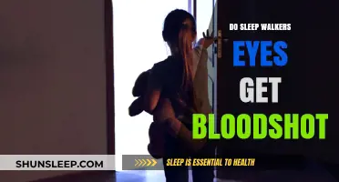 Sleepwalking and Eye Health: Do Sleepwalkers Get Bloodshot Eyes?