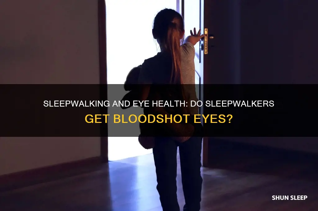 do sleep walkers eyes get bloodshot