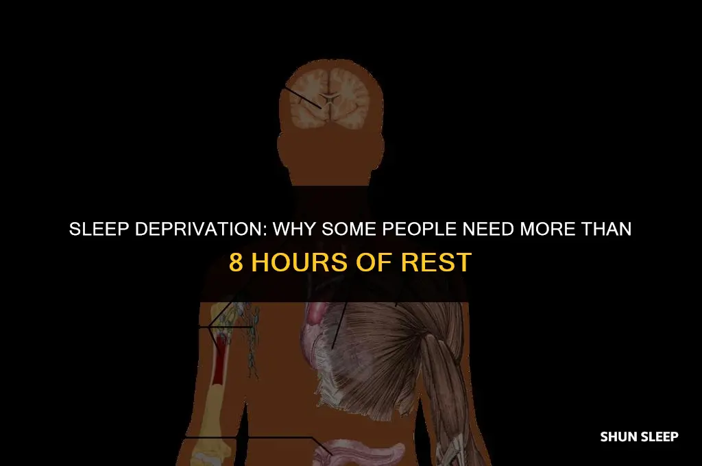 do some people need 10 hours of sleep