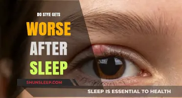 Does Sleep Worsen Styes? Understanding Overnight Eye Infection Changes