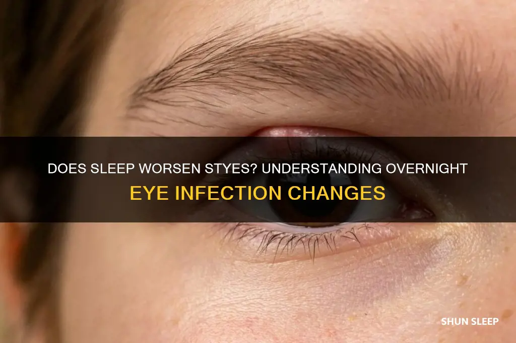 do stye gets worse after sleep