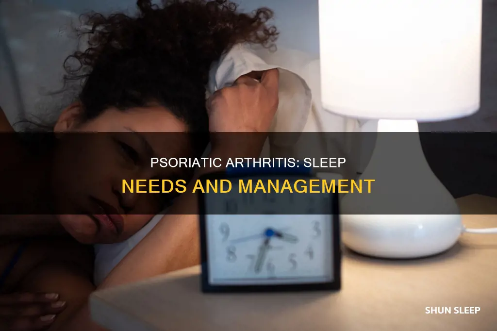 do sufferers of psoriatic arthritis need lots of sleep