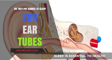 Ear Tube Surgery for Babies: Is General Anesthesia Necessary?