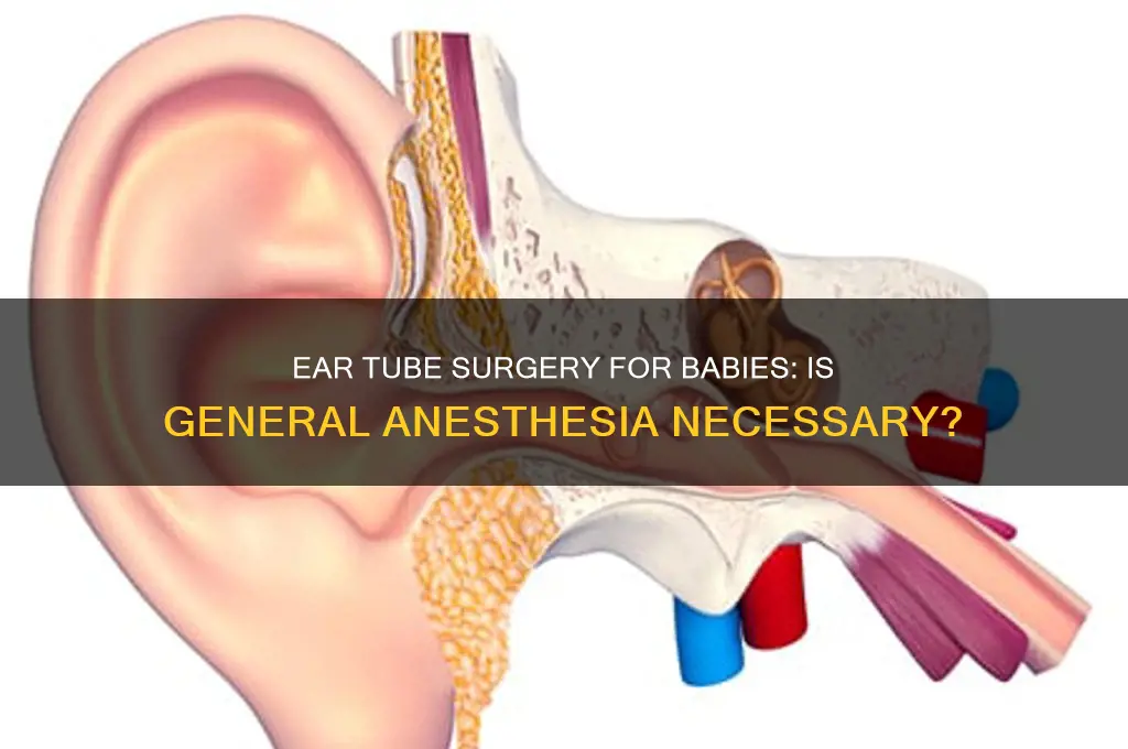 do they put babies to sleep for ear tubes