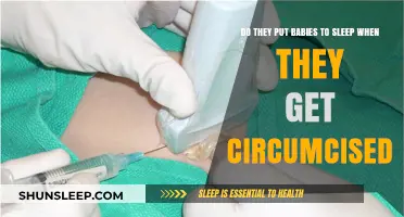 Circumcision and Newborns: Understanding Anesthesia Use During the Procedure