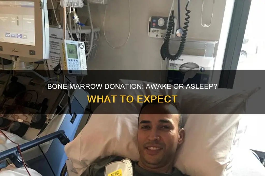 do they put you to sleep to get bone marrow