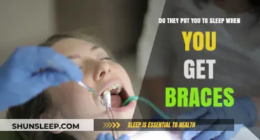 Do Braces Require Anesthesia? Debunking Myths About Orthodontic Procedures