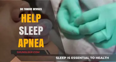 Tongue Devices for Sleep Apnea: Effective Solutions or Just a Trend?