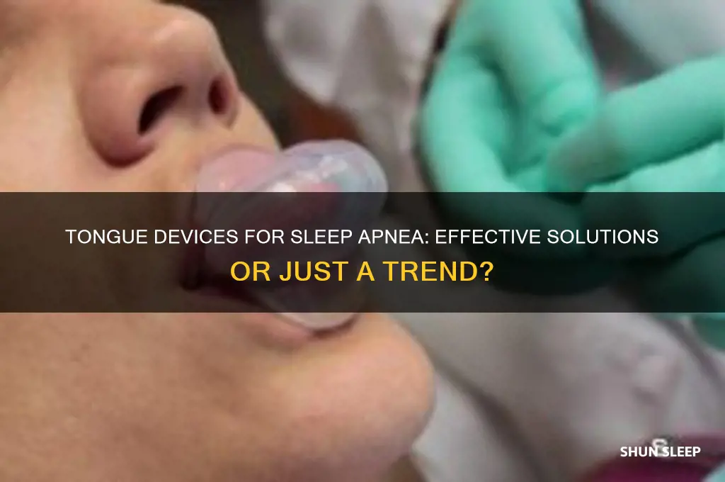 do tongue devises help sleep apnea
