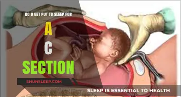 C-Section Anesthesia: Understanding Sedation During Cesarean Delivery