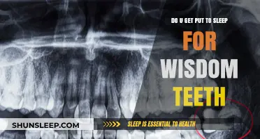 Wisdom Teeth Removal: Anesthesia Options and What to Expect
