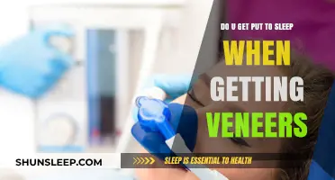 Veneers Procedure Explained: Are You Sedated During the Process?
