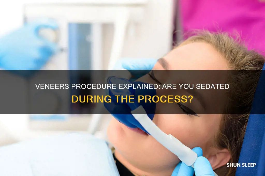 do u get put to sleep when getting veneers