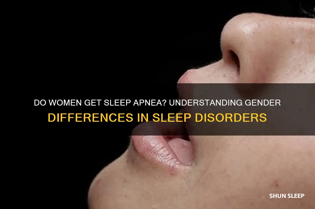 do women get sleep apnea