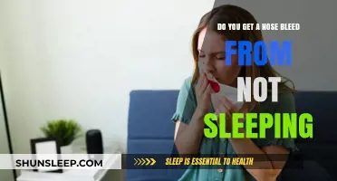 Lack of Sleep and Nosebleeds: Uncovering the Surprising Connection