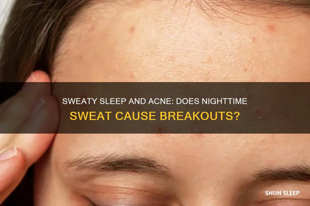 do you get acne by sleeping with a sweaty face