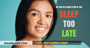Sleeping Late and Baggy Eyes: Uncovering the Surprising Connection