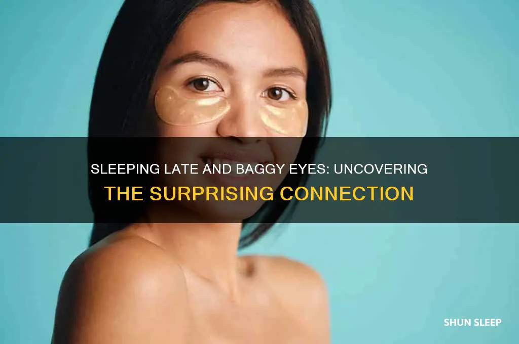 do you get baggy eyes if you sleep too late