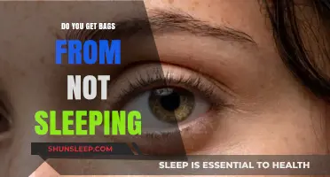 Lack of Sleep and Under-Eye Bags: Uncovering the Connection