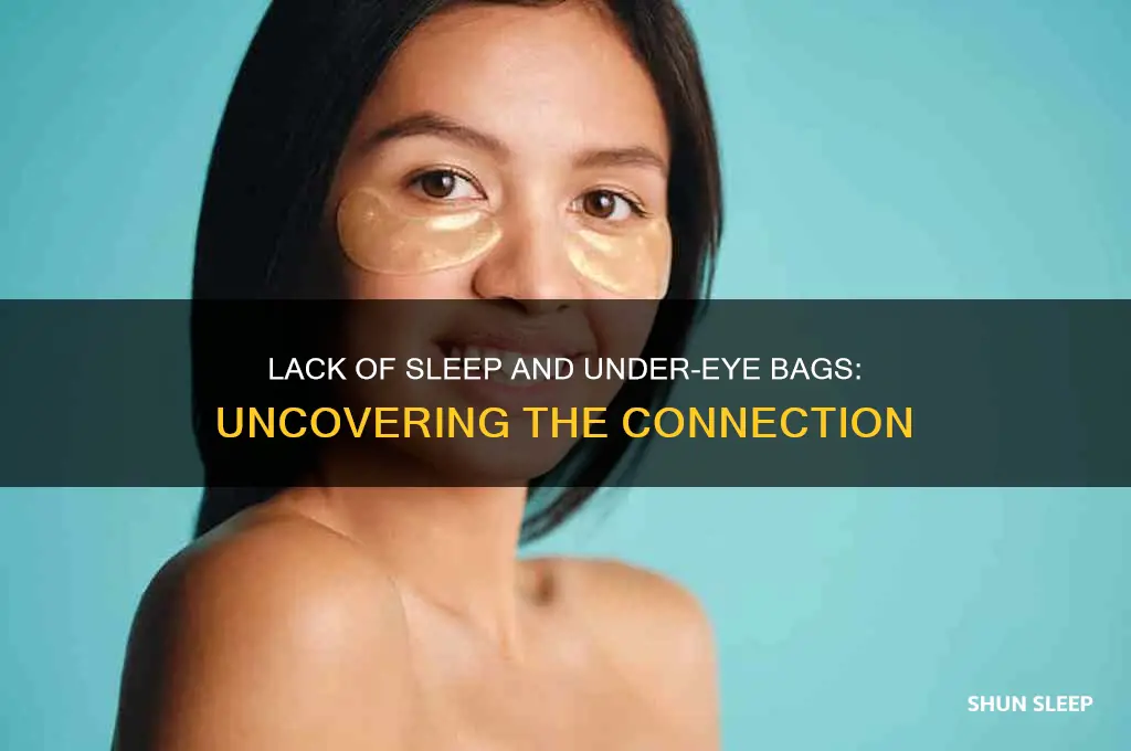 do you get bags from not sleeping