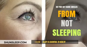 Lack of Sleep and Dark Circles: Uncovering the Connection and Solutions