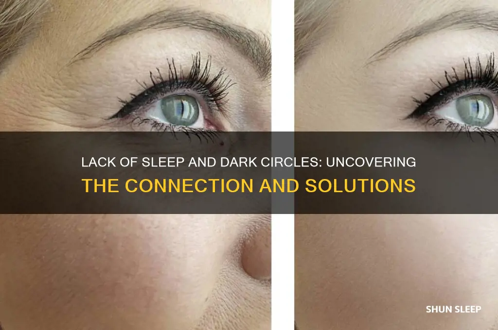 do you get dark circles from not sleeping
