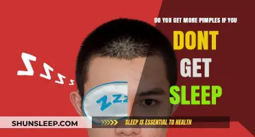 Lack of Sleep and Acne: How Sleepless Nights Affect Your Skin