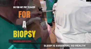 Do You Get Put to Sleep for a Biopsy? Understanding the Procedure