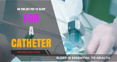 Do You Get Put to Sleep for a Catheter? Anesthesia Explained