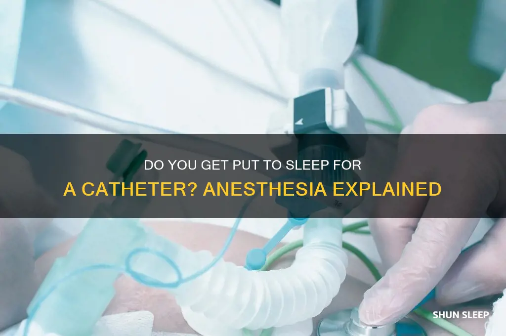 do you get put to sleep for a catheter