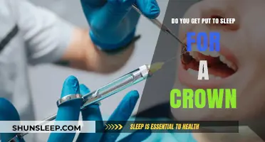 Do You Need Anesthesia for a Dental Crown Procedure?