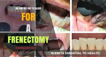 Frenectomy Procedure: Understanding Anesthesia and What to Expect During Surgery