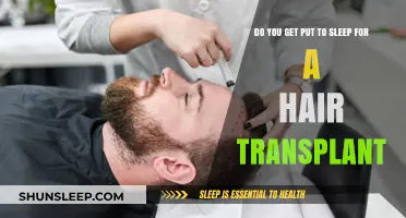 Hair Transplant Anesthesia: Do You Need to Be Put to Sleep?