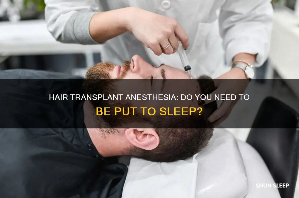 do you get put to sleep for a hair transplant