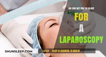 Laparoscopy Anesthesia Explained: Understanding Sedation During Minimally Invasive Surgery