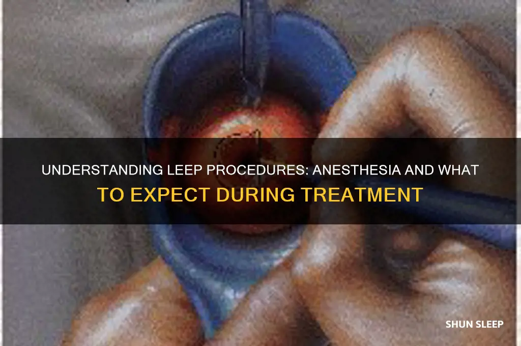 do you get put to sleep for a leep procedure