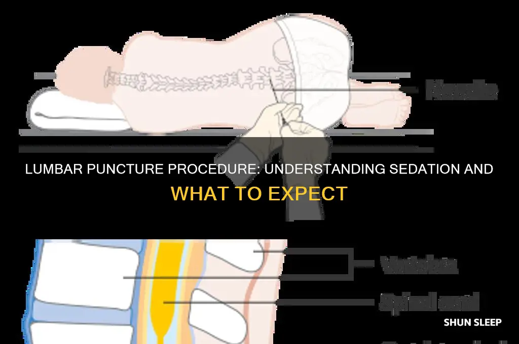 do you get put to sleep for a lumbar puncture